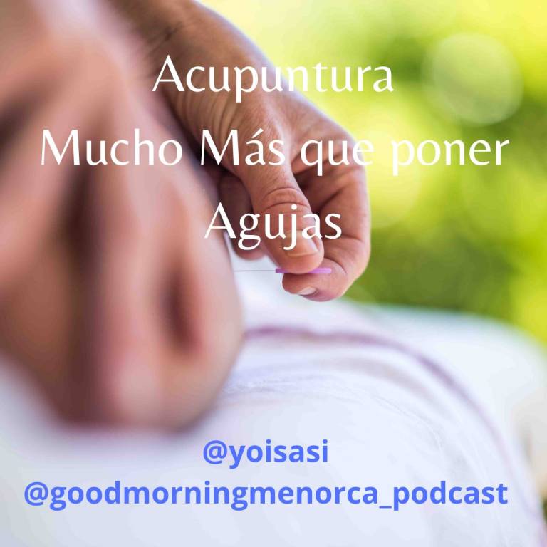 Acupuntura Mucho Más que poner Agujas