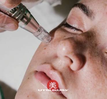 ENPITSU Rejuvenecimiento Facial