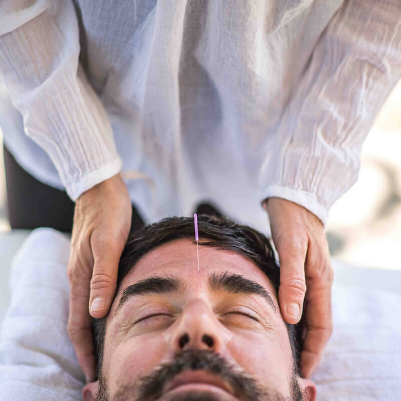 acupuntura-facial-yo-isasi