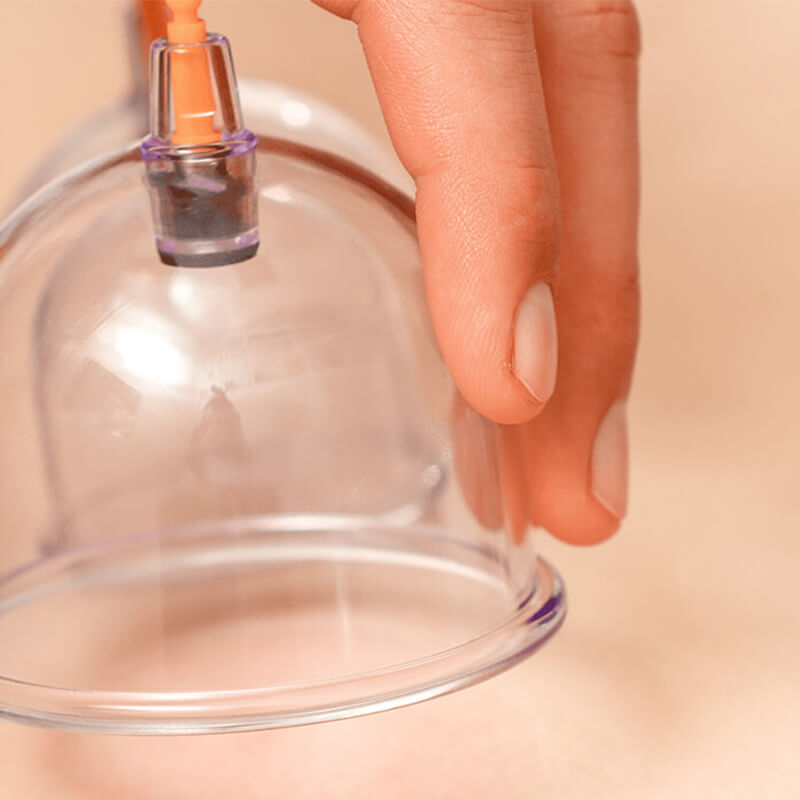 terapia-ventosas-isasi